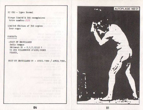 Fichier:Compilation autoplasie 02.jpg